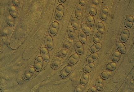 ascospores