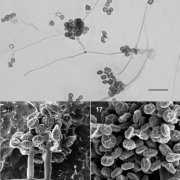 Microscopic view of Stephanosporium fungiuced-in-clusters-at Microscopic view of Stephanosporium fungi