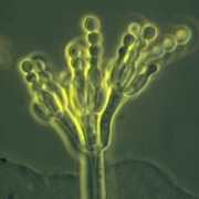 pages-images-Penicillium.jpg Microscopic view of Penicillum mold