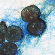 Microscopic view of Phoma fungi Microscopic view of Phoma fungi