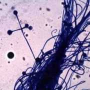 Microscopic view of absidia mold Microscopic view of absidia mold