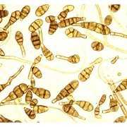 Microscopic view of Alternaria mold