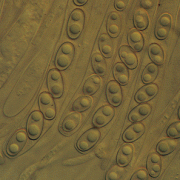 Microscopic view of Ascospores mold