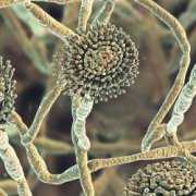 Close up view of Aspergillus Mold spores Microscopic view of black mold