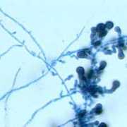 Microscopic view of Epicoccum mold