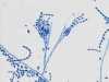 pages-images-pacilomyces.jpg Microscopic view of Pacilomyces mold