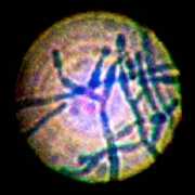 pages-images-trichoderma1.jpg Microscopic view of Trichoderma mold