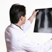 Doctor holding x-ray Physican hold an x-ray of lungs