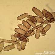 Microscopic view of Bipolaris mold spores Microscopic view of Bipolaris mold