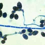 ulocladium mold spores Microscopic image of Ulocladium mold spores