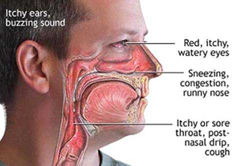 Mold nasal cross section Mold Help The World s Largest TOXIC 