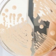 Candida auris in a petri dish Petri dish showing Candida auris strain of mold
