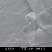 mold-884056_640 Microscopic view of Aspergillus Mold
